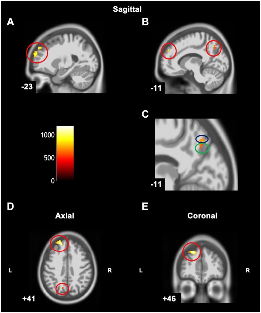 Cortical Grey Matter